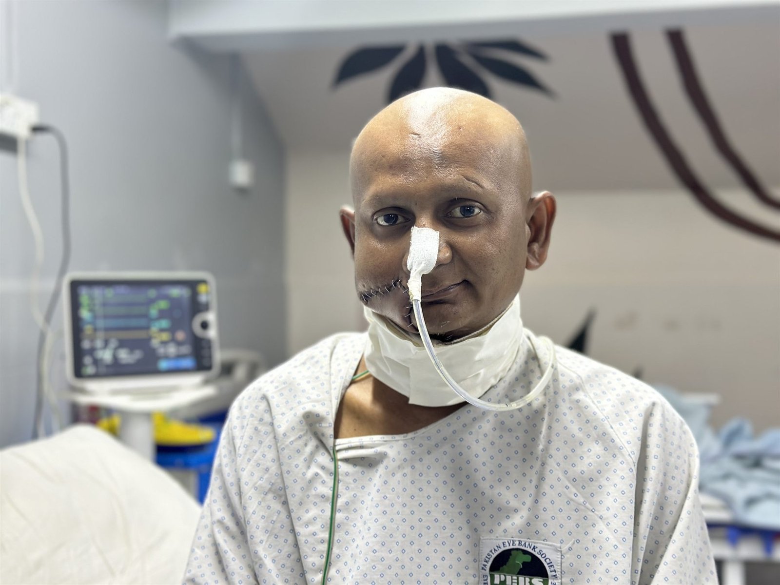 Patient recovering after surgery in the surgical ICU at PEBS Hospital